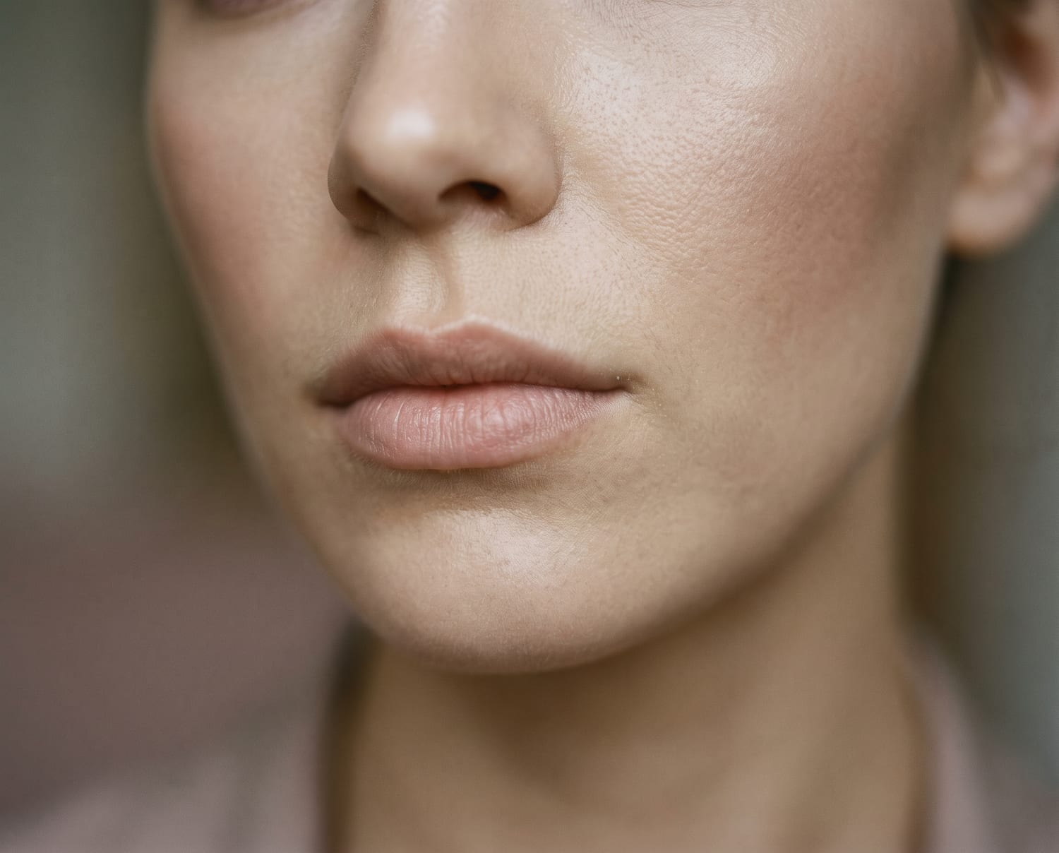 Dermal fillers
