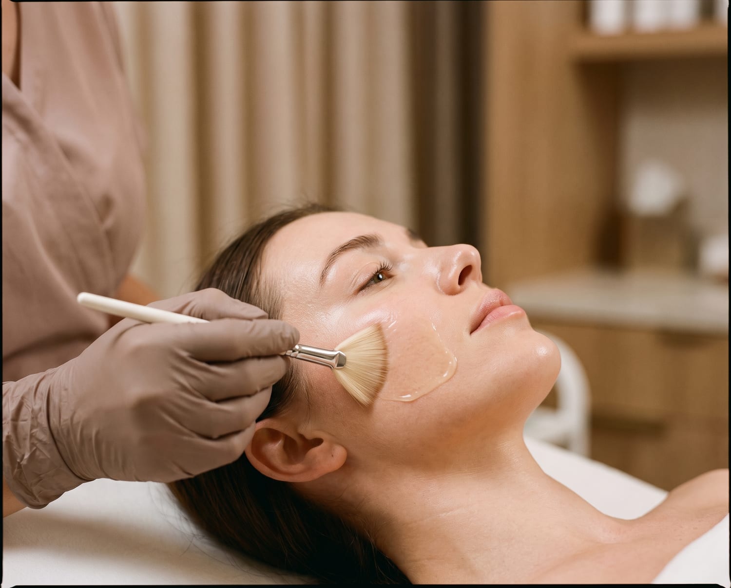 Chemical peels